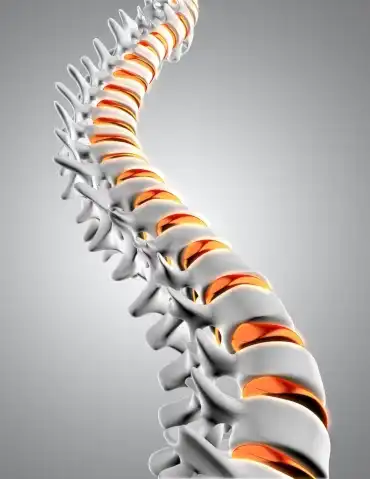 Spine Image | Chiropractor in Hamilton, ON Spine Image | Chiropractor in Hamilton, ON
